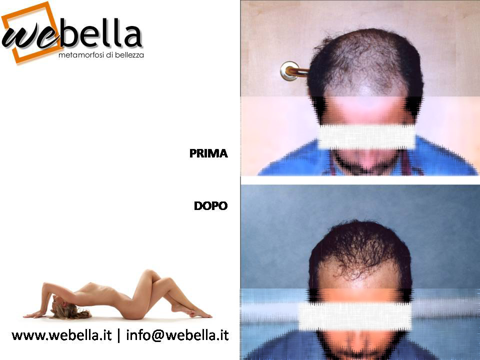 23. Impianto Capelli 23. Impianto Capelli